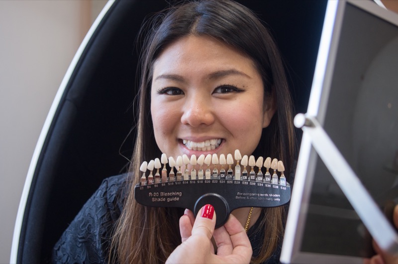 牙齿美白:对大多数人来说，牙齿美白治疗的效果会持续一到三个月